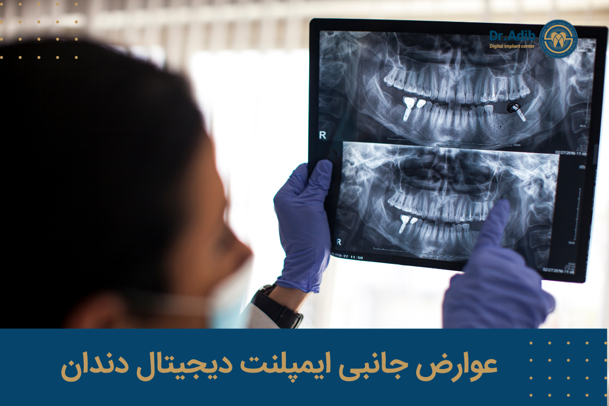 عوارض جانبی ایمپلنت دیجیتال دندان