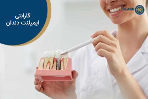 گارانتی ایمپلنت دندان