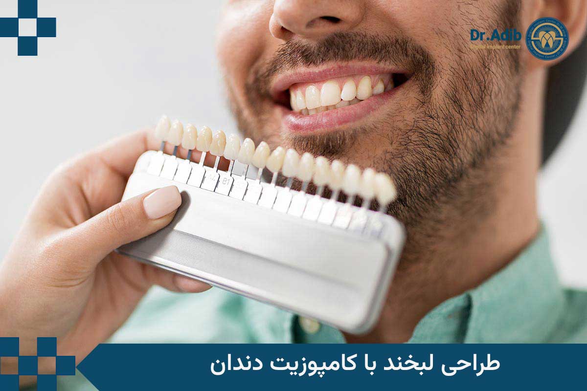 طراحی لبخند کامپوزیت دندان