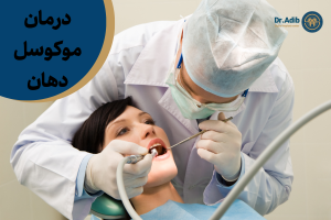 درمان موکوسل دهان