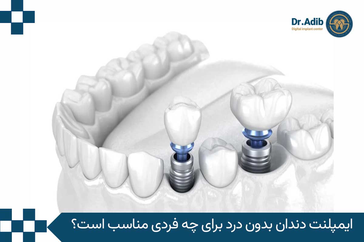 افراد مناسب ایمپلنت دندان بدون درد 